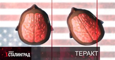 Ухо Трампа.