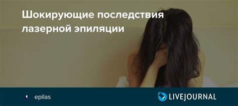 Шокирующие последствия лазерной эпиляции: epilas — LiveJournal