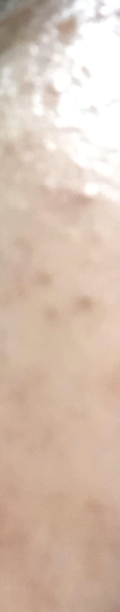 [Skin concerns] how do I get rid of super deep blackheads on my face ...
