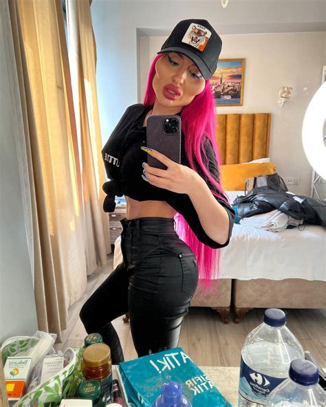 La femme aux « plus grosses joues du monde » subit une nouvelle