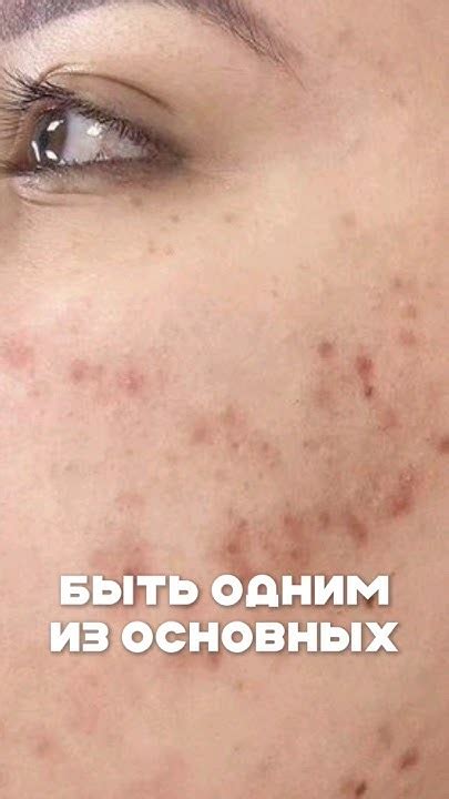 Лучшие препараты для лечения кожи #shorts - YouTube