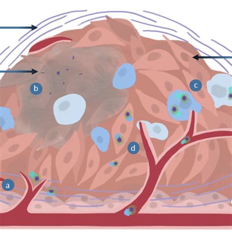 Obstacles associated with tumor accumulation: (a) Poor diffusion ...
