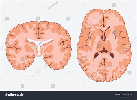 brain horizontal cross section   royalty  licensable stock