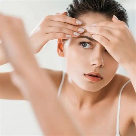 Stagnant red spots after acne: how to remove red spots on the face at home