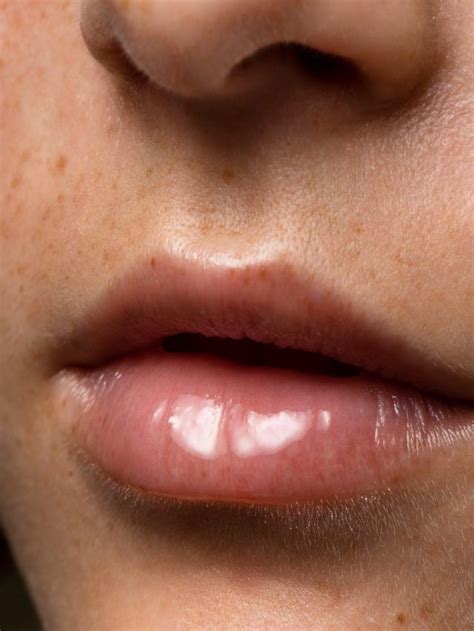dark spots  lips    remedies news