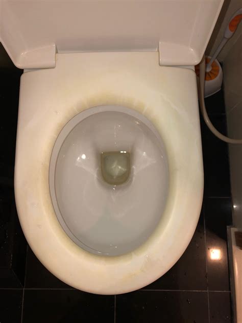 Replace Toilet Seat & Cover - Common Issues & Their Solutions