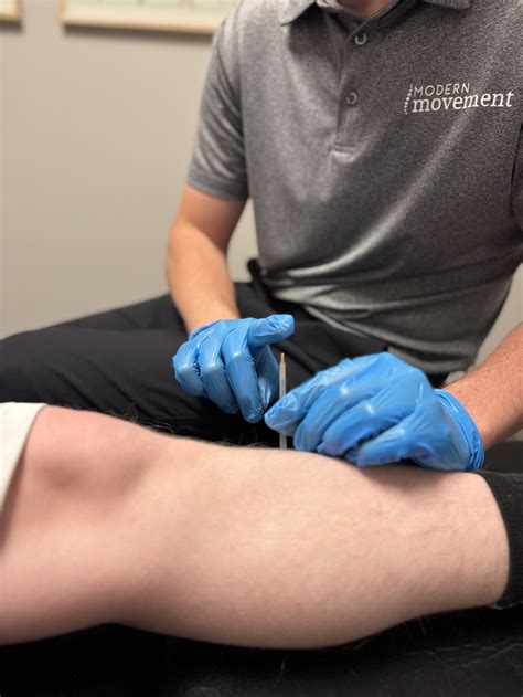 Dry-Needling — Modern Movement Chiropractic & Rehab