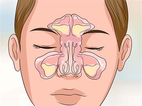 Stuffy Nose X Ray at Kai Chuter blog