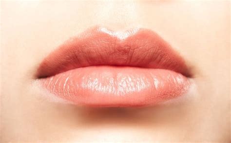 upper lip lift institutomedicolaser