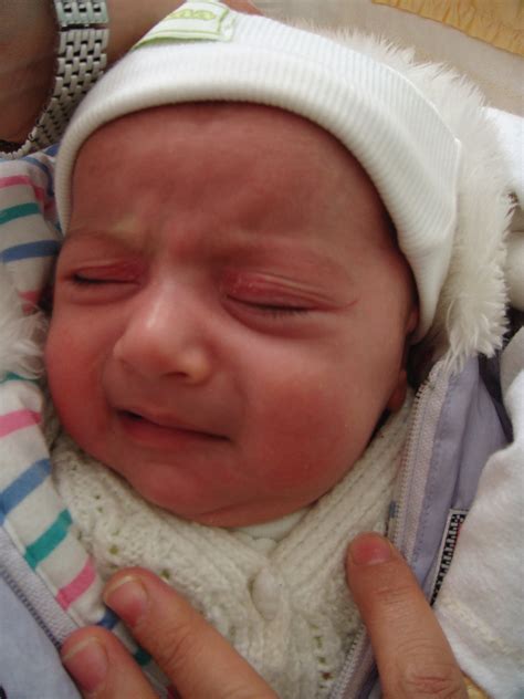 Annular Skin Lesions in Infancy - Clinics in Dermatology