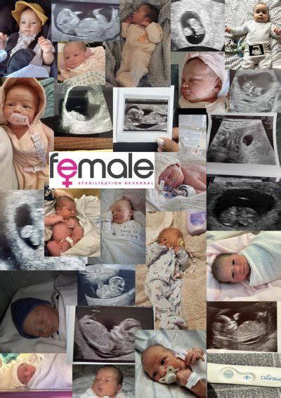 Female Sterilization Reversal Clinic: A Decade of Success - Female ...