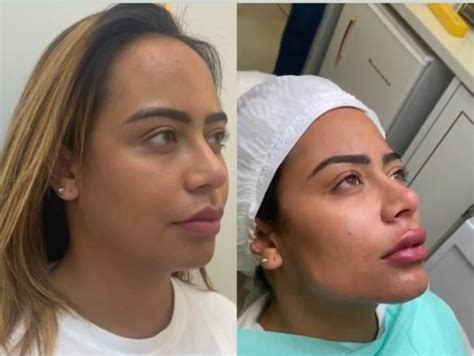 Walkyria Santos Antes E Depois - Walkyria Santos Antes E Depois, Rafaella Santos exibe seu novo visual ...