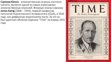 Саркома Юинга - презентация онлайн