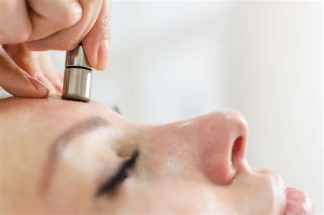 Microdermabrasion - Thames Skin Clinic