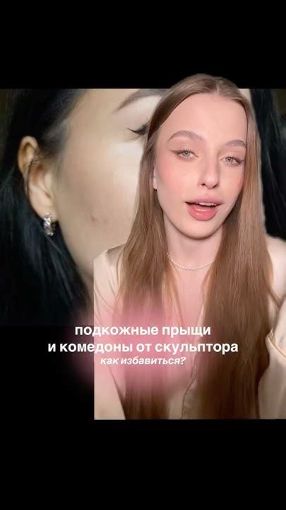 как избавиться от подкожных прыщей и комедонов на скулах от скульптора ...