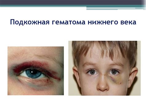 Первая помощь при травмах глаза презентация, доклад