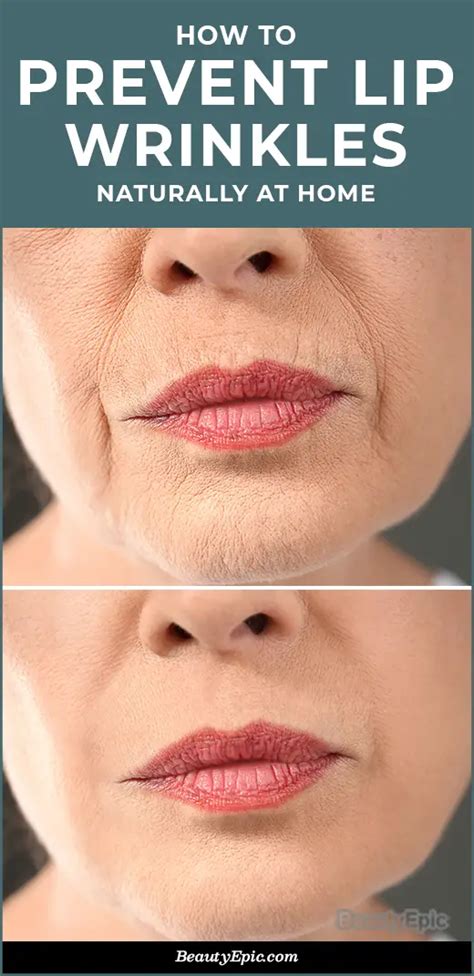 How To Get Rid Of Wrinkles On Lips Naturally