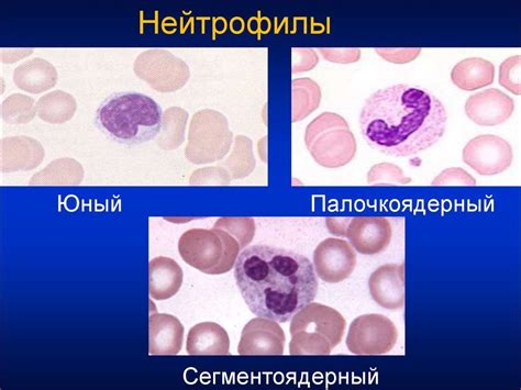 Юные нейтрофилы крови :: описание, нормы, причины