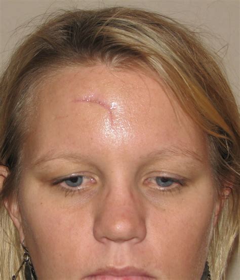 scar face 2 9