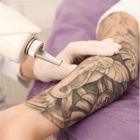 Laser Tattoo Removal - Derma Revive Skin Clinic