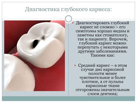 Глубокий кариес - презентация онлайн