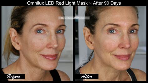 OmniLux LED Mask ~ 3 Month Results! Before & After Face, Neck, & Hand ...