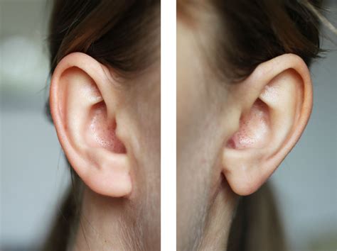 Are Attached Earlobes Rare - slideshare