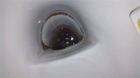 Richtig fieser Urinstein ;(( (Toilette)