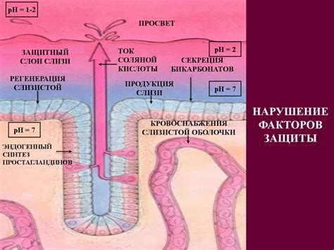 Хирургическое лечение язвенной болезни желудка и двенадцатиперстной ...