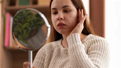 jenis jenis penyakit kulit  perlu  ketahui primaya hospital