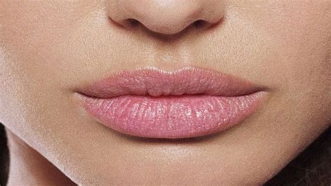 Chirurgia estetica: labbra perfette senza bisturi | DireDonna