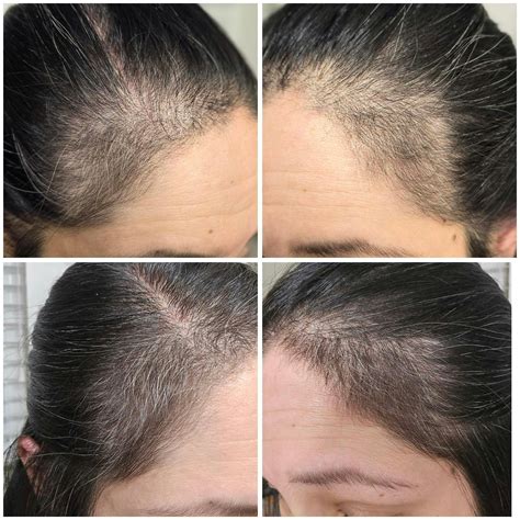 liquid multivitamin for hair growth 7