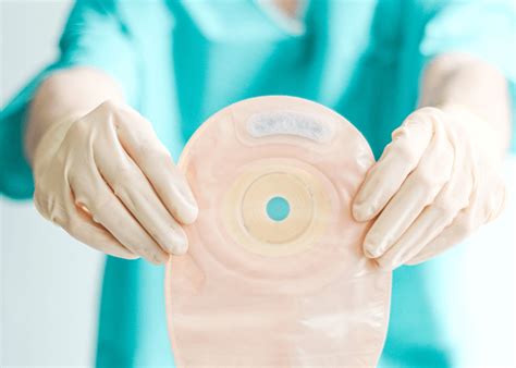 stoma care bladder bowel community