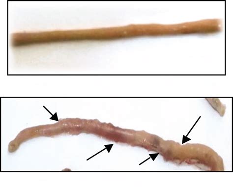 macroscopic lesions  intestine caecum  ileum  healthy