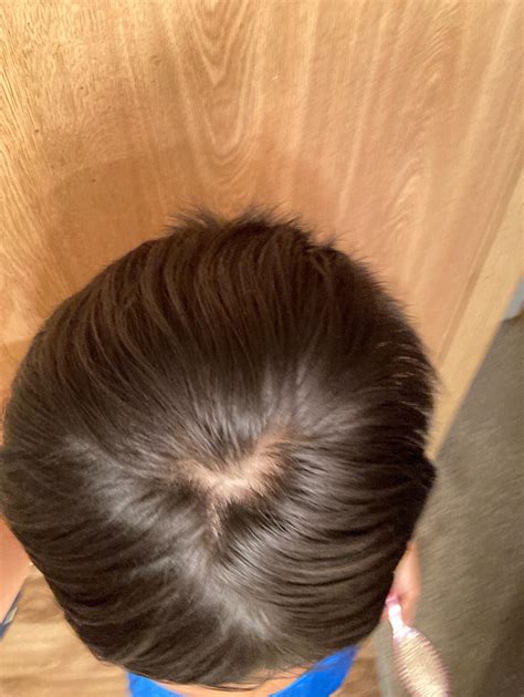 Men are venting about their hair with cowlick struggles on reddit 15