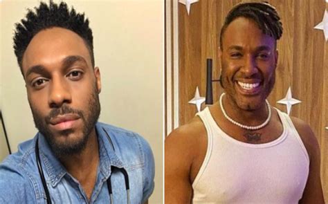 Fred Nicacio Antes E Depois - Confira o antes e depois da harmonização facial do participante Fred ...