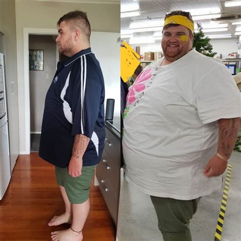 Mexico Bariatric Center