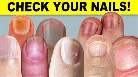 9 Things Fingernails Can Tell About Your Health