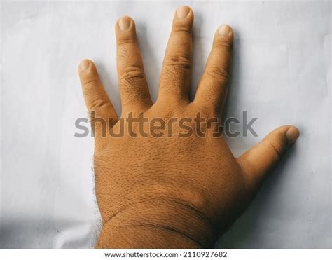 fat  hands images stock  vectors shutterstock
