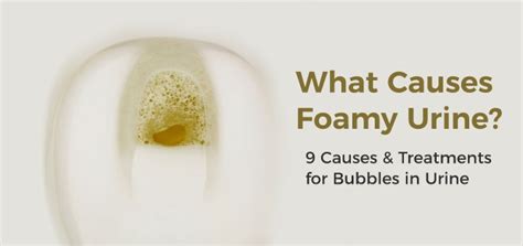 9 Possible Causes of Foamy Urine and How Is It Treated