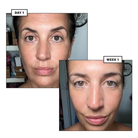 How Sobriety at 48 Gave Me The Skin I Was Chasing For Years | Allure