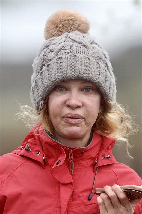 Estetik bağımlısı Alicia Douvall için o günler geride kaldı