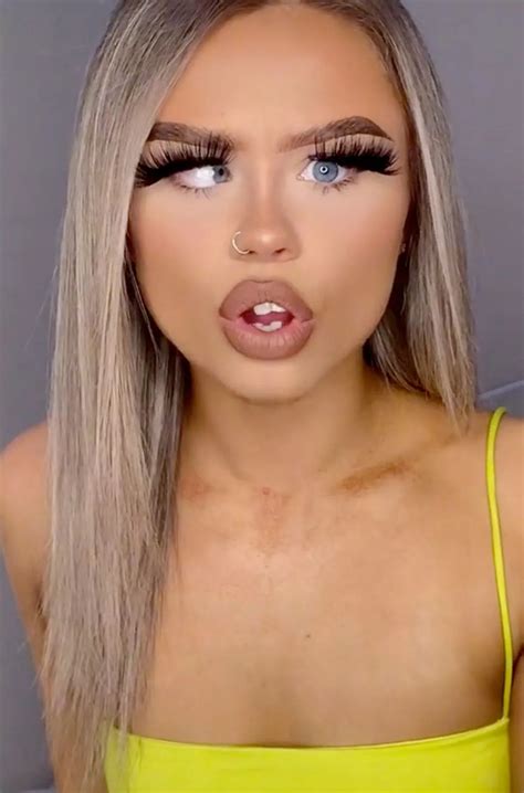 Elley Davies defies bullies who poke fun at 'lazy' eye - Daily Star