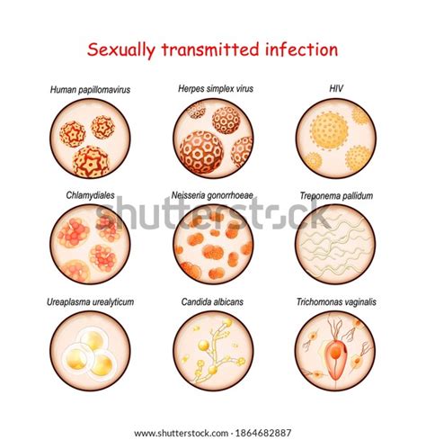 EaD&Tutoria: Infecções sexualmente transmissíveis - ISTs