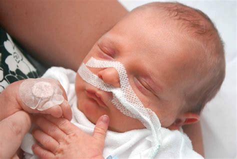 facts  infant respiratory distress factsnet