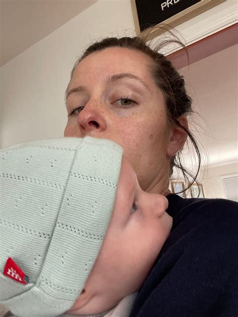 Measles Outbreak: Parents Who Can't Vaccinate Their Kids