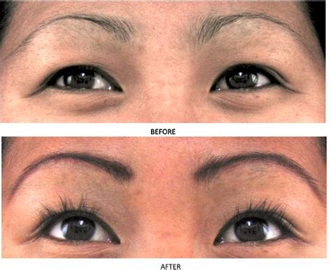 MD® Lash Factor - Best Eyelash Growth Conditioner | MD®
