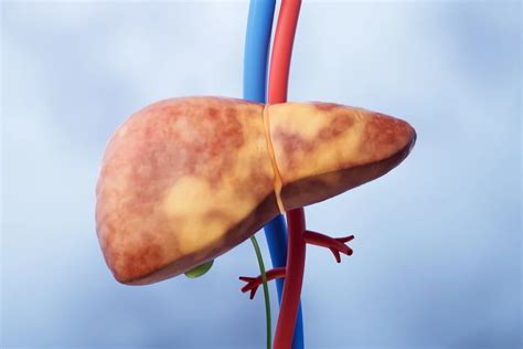 Creatina Faz Mal Para O Fígado - Endocrinologista explica se tomar creatina faz mal à saúde do fígado