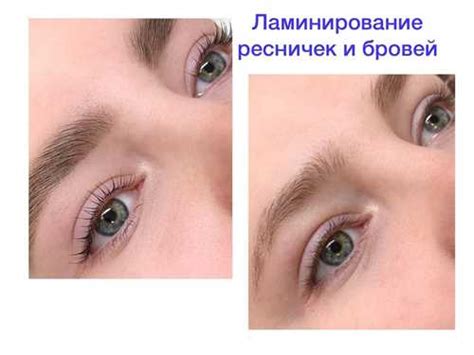 Жемчужное коллагенирование бровей — что это фото, отзывы
