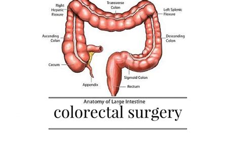 Useful information and tips about colorectal surgery ...